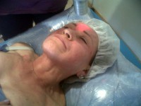REJUVENECIMIENTO FACIAL